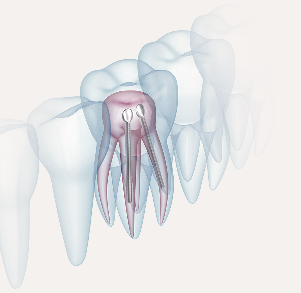 当院は、根管治療専門医院です。